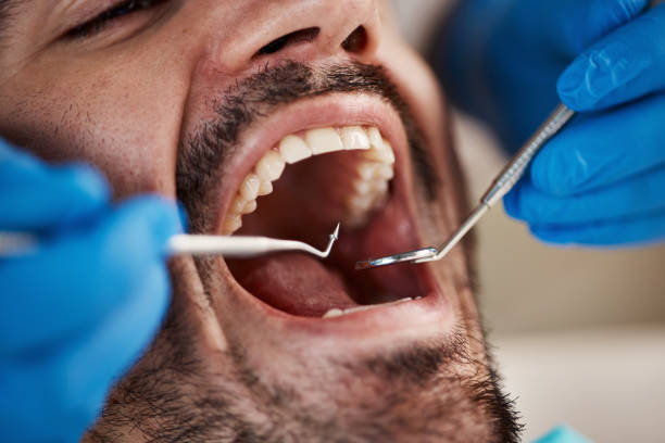 Best Emergency Root Canal Treatment in High Point, NC